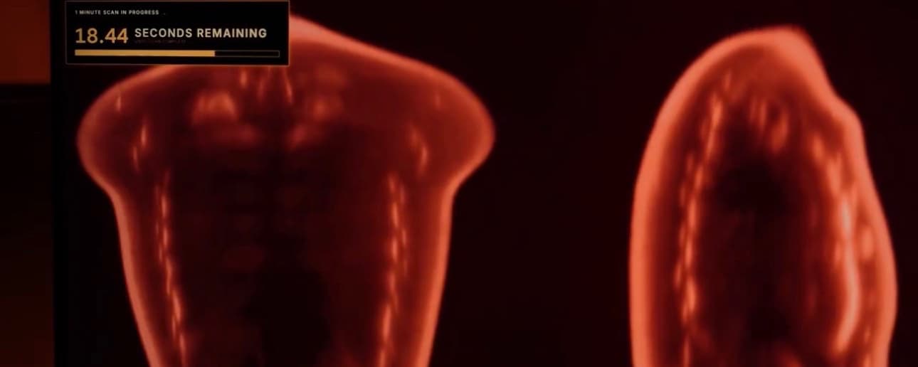 The Midjourney Scanner: From AI Image Generation to Revolutionary Full-Body Ultrasonic Imaging